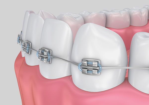 Best orthodontic in barishal Bangladesh