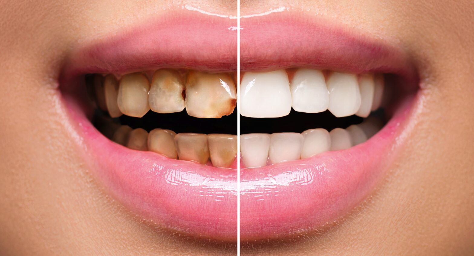 Restorative Dentistry 2