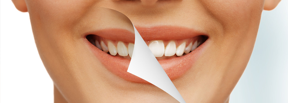 cosmetic-dentistry 5