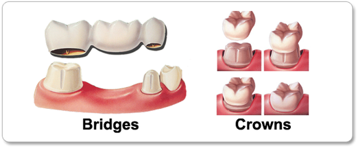 crown5