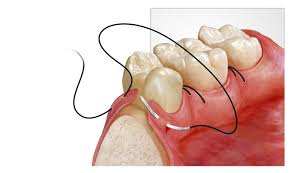oral