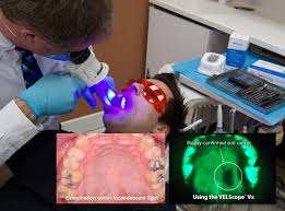 Cancer Detection & Surgery: A Comprehensive Guide