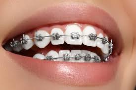 ortho 1