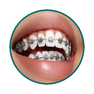 ortho