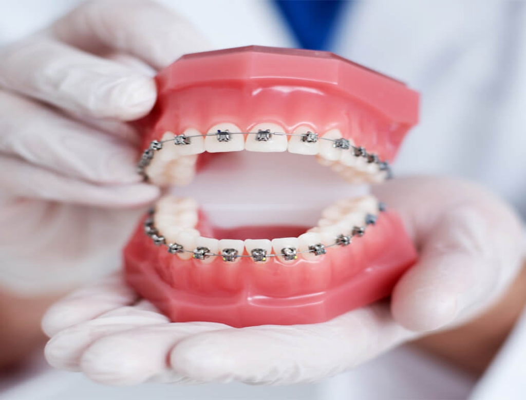 orthodontic-treatment 24