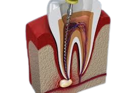 root r