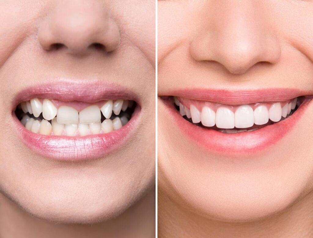 smile