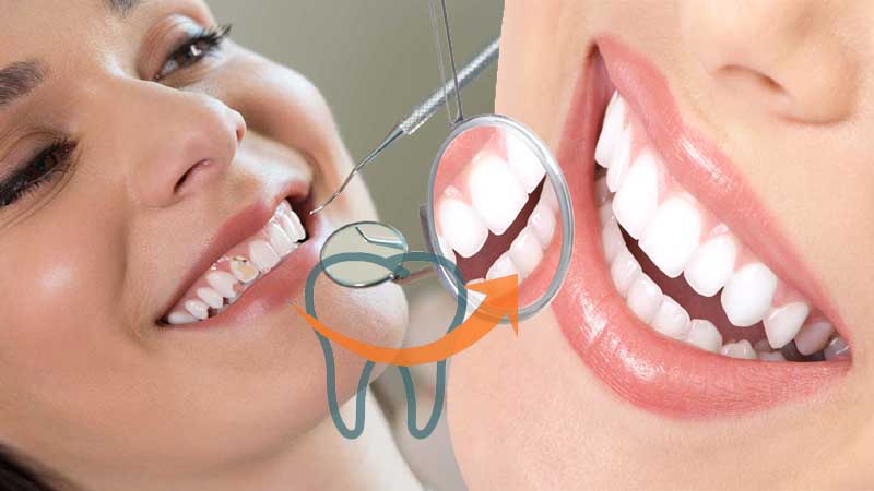 smile 5