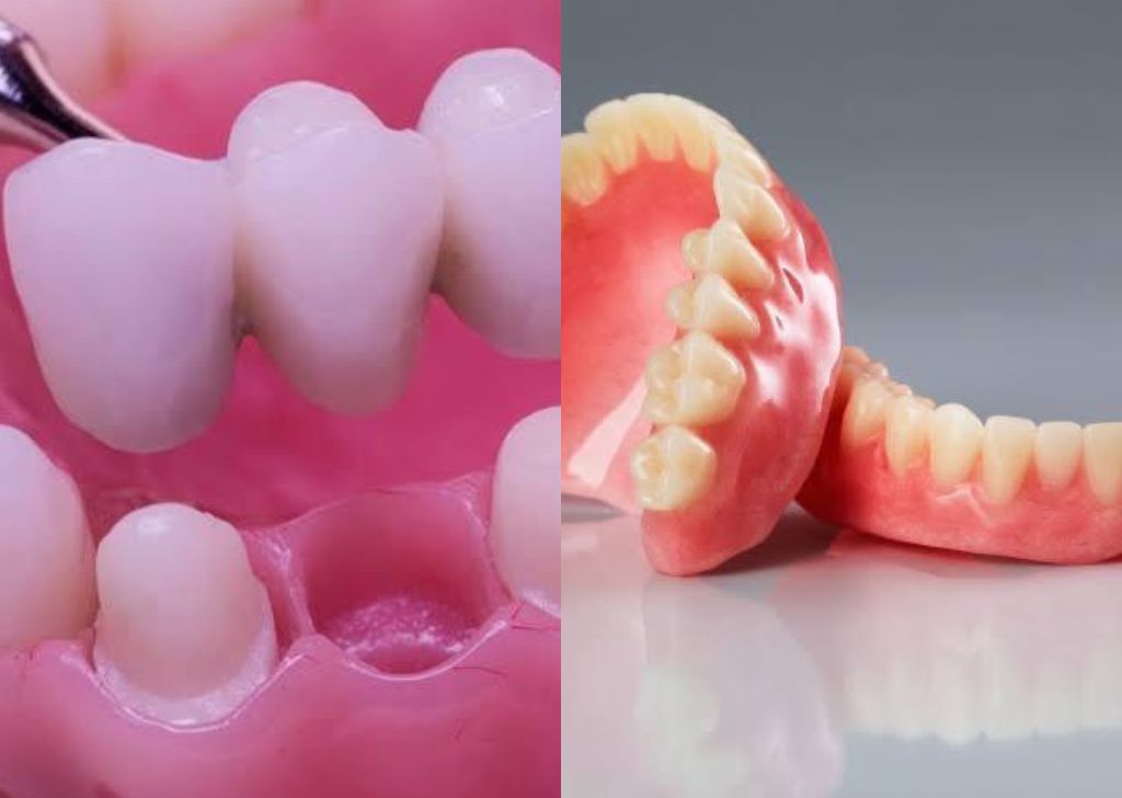 prosthodontics 1