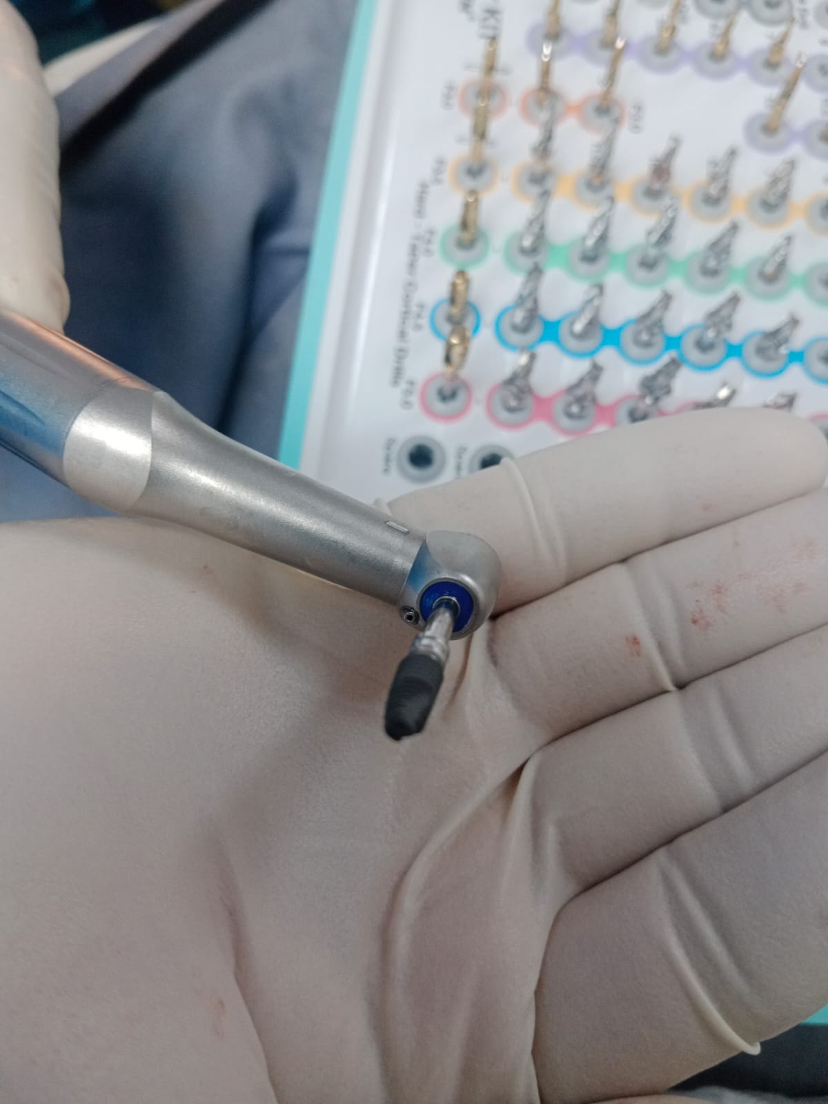 Best Dental Implant in Shantinagar, Dhaka | Top Implant Clinic
